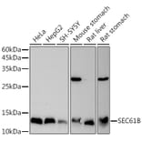 Western Blot - Anti-SEC61B Antibody (A307609) - Antibodies.com