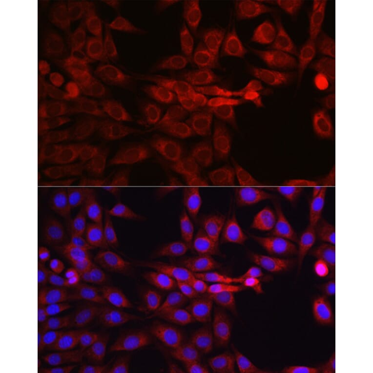 Immunofluorescence - Anti-SEC61B Antibody (A307609) - Antibodies.com