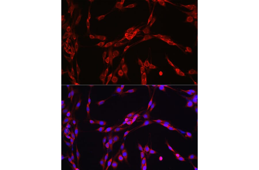 Immunofluorescence - Anti-SEC61B Antibody (A307609) - Antibodies.com