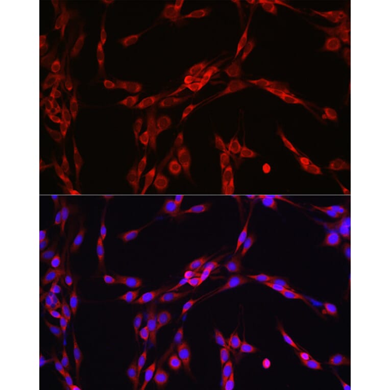 Immunofluorescence - Anti-SEC61B Antibody (A307609) - Antibodies.com