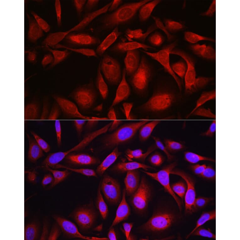 Immunofluorescence - Anti-SEC61B Antibody (A307609) - Antibodies.com