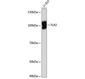 Western Blot - Anti-TLR2 Antibody [ARC0433] (A307610) - Antibodies.com