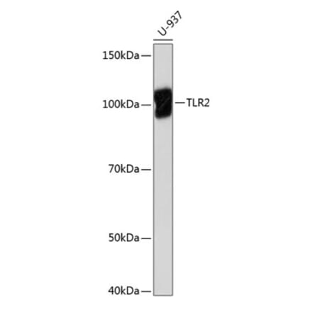 Western Blot - Anti-TLR2 Antibody [ARC0433] (A307610) - Antibodies.com