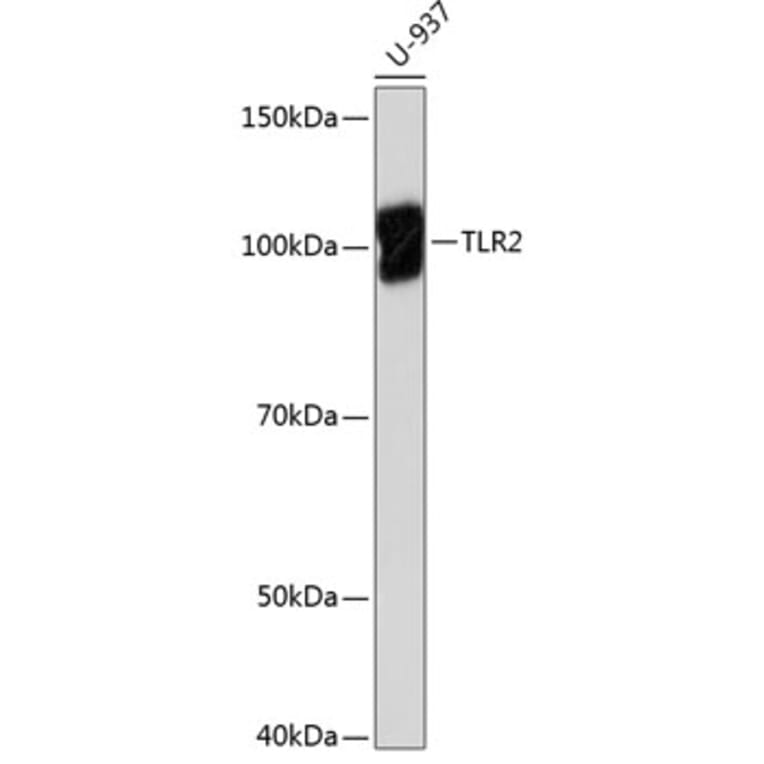 Western Blot - Anti-TLR2 Antibody [ARC0433] (A307610) - Antibodies.com