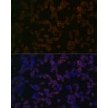 Immunofluorescence - Anti-TLR2 Antibody [ARC0433] (A307610) - Antibodies.com