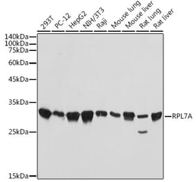 Western Blot - Anti-RPL7A Antibody [ARC2407] (A307611) - Antibodies.com