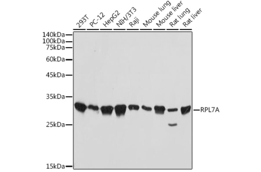 Western Blot - Anti-RPL7A Antibody [ARC2407] (A307611) - Antibodies.com