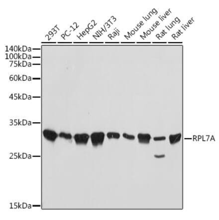 Western Blot - Anti-RPL7A Antibody [ARC2407] (A307611) - Antibodies.com