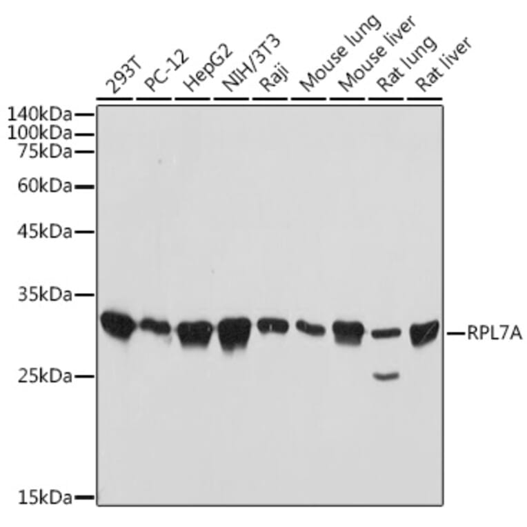 Western Blot - Anti-RPL7A Antibody [ARC2407] (A307611) - Antibodies.com