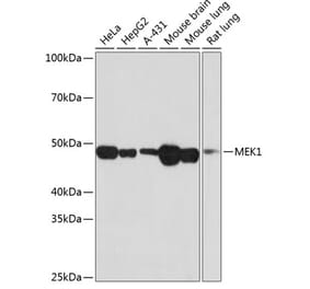 Western Blot - Anti-MEK1 Antibody [ARC0044] (A307613) - Antibodies.com