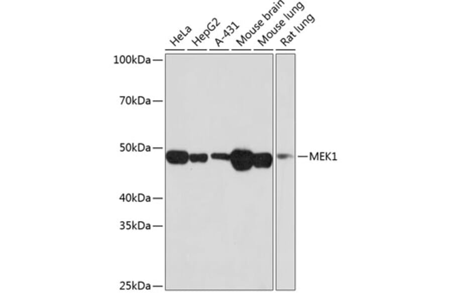 Western Blot - Anti-MEK1 Antibody [ARC0044] (A307613) - Antibodies.com