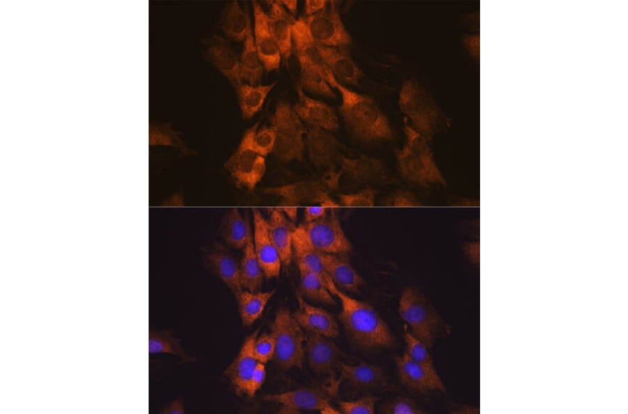 Immunofluorescence - Anti-MEK1 Antibody [ARC0044] (A307613) - Antibodies.com