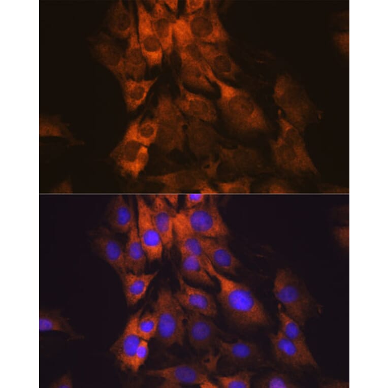 Immunofluorescence - Anti-MEK1 Antibody [ARC0044] (A307613) - Antibodies.com