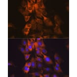 Immunofluorescence - Anti-MEK1 Antibody [ARC0044] (A307613) - Antibodies.com