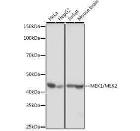 Western Blot - Anti-MEK1 + MEK2 Antibody [ARC0292] (A307614) - Antibodies.com
