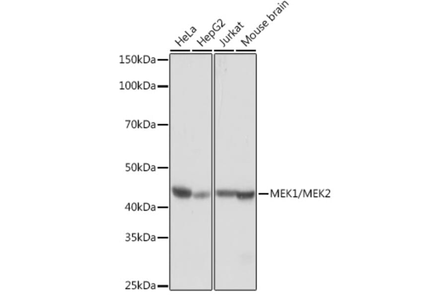 Western Blot - Anti-MEK1 + MEK2 Antibody [ARC0292] (A307614) - Antibodies.com