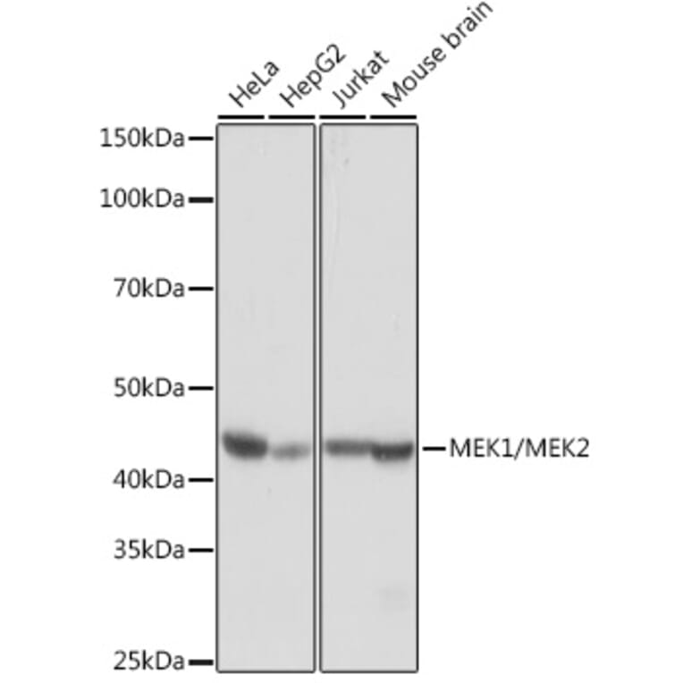 Western Blot - Anti-MEK1 + MEK2 Antibody [ARC0292] (A307614) - Antibodies.com