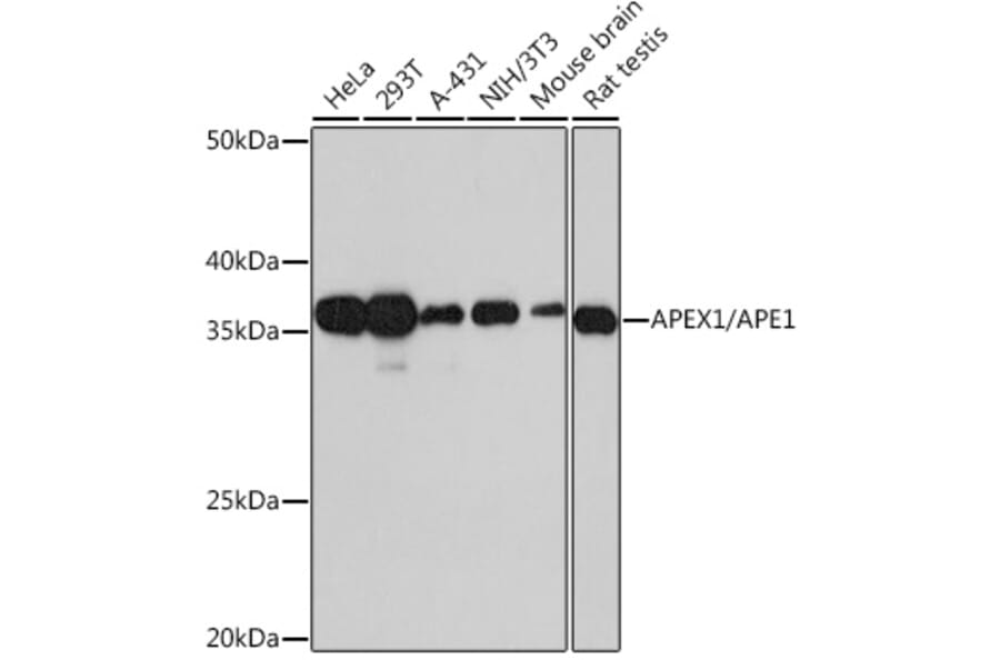 Western Blot - Anti-APE1 Antibody [ARC0556] (A307615) - Antibodies.com
