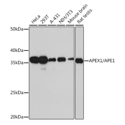 Western Blot - Anti-APE1 Antibody [ARC0556] (A307615) - Antibodies.com