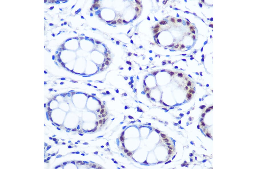 Immunohistochemistry - Anti-APE1 Antibody [ARC0556] (A307615) - Antibodies.com