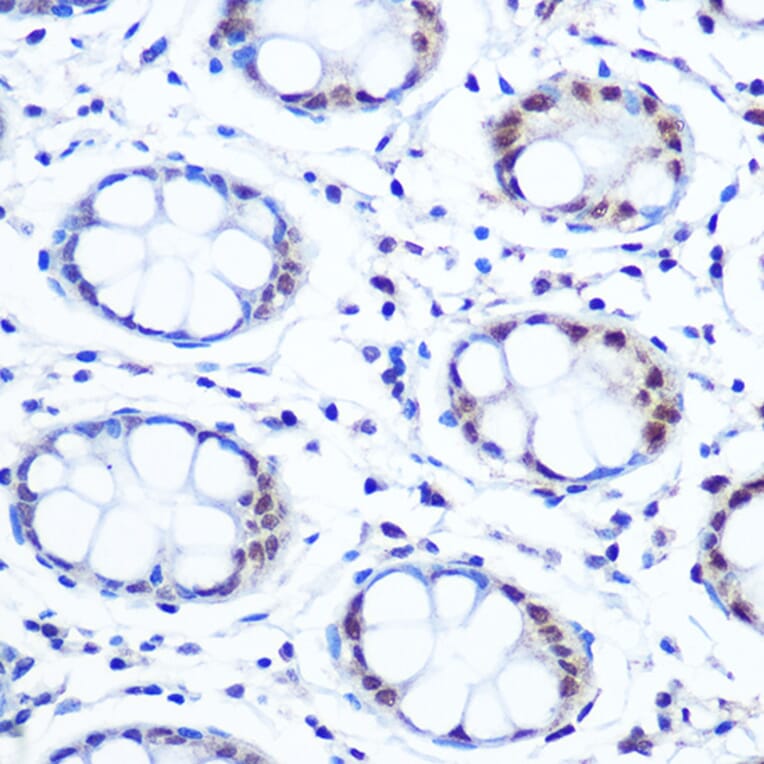 Immunohistochemistry - Anti-APE1 Antibody [ARC0556] (A307615) - Antibodies.com