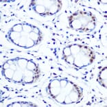 Immunohistochemistry - Anti-APE1 Antibody [ARC0556] (A307615) - Antibodies.com