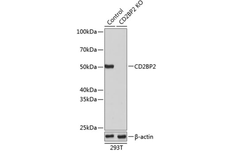 Western Blot - Anti-CD2BP2 Antibody (A307616) - Antibodies.com