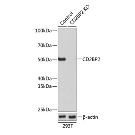 Western Blot - Anti-CD2BP2 Antibody (A307616) - Antibodies.com