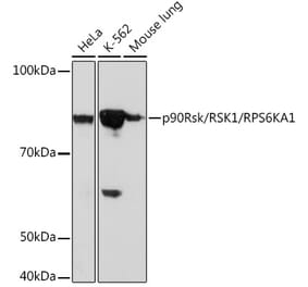 Western Blot - Anti-RSK1 p90 Antibody [ARC1096] (A307617) - Antibodies.com