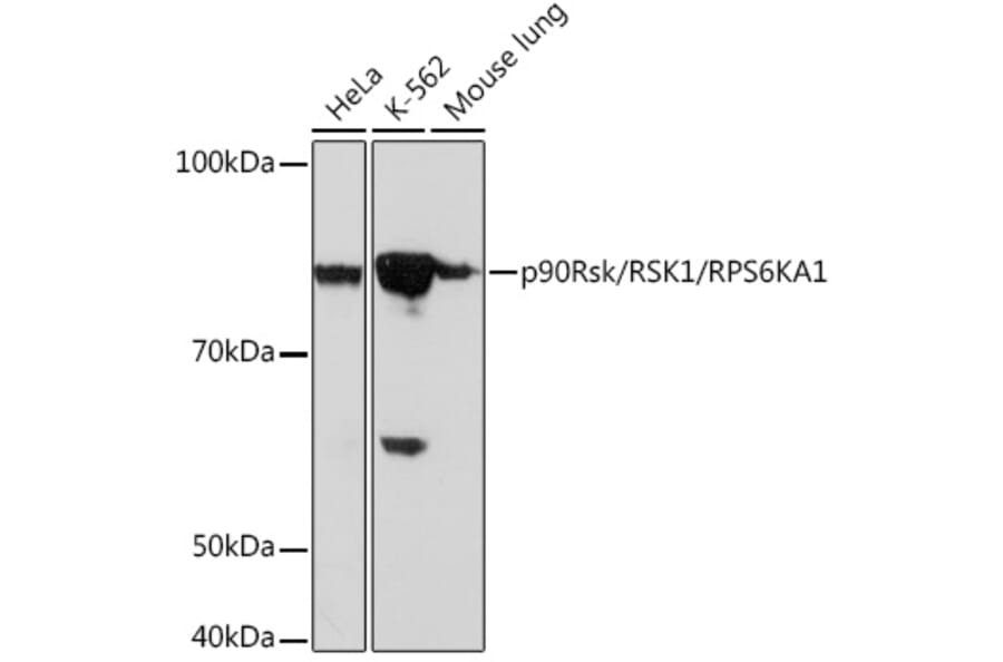 Western Blot - Anti-RSK1 p90 Antibody (A307617) - Antibodies.com