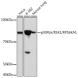 Western Blot - Anti-RSK1 p90 Antibody (A307617) - Antibodies.com