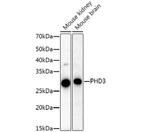 Western Blot - Anti-PHD3 Antibody [ARC52452] (A307618) - Antibodies.com