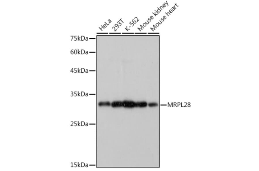 Western Blot - Anti-MRPL28 Antibody [ARC2507] (A307620) - Antibodies.com