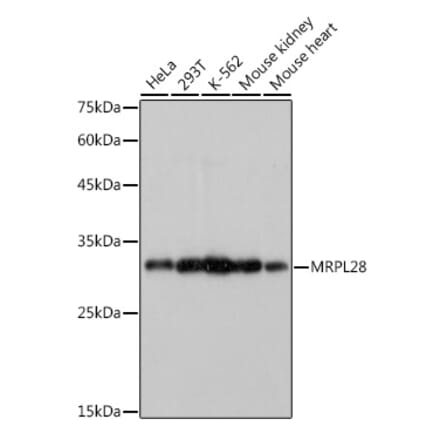 Western Blot - Anti-MRPL28 Antibody [ARC2507] (A307620) - Antibodies.com