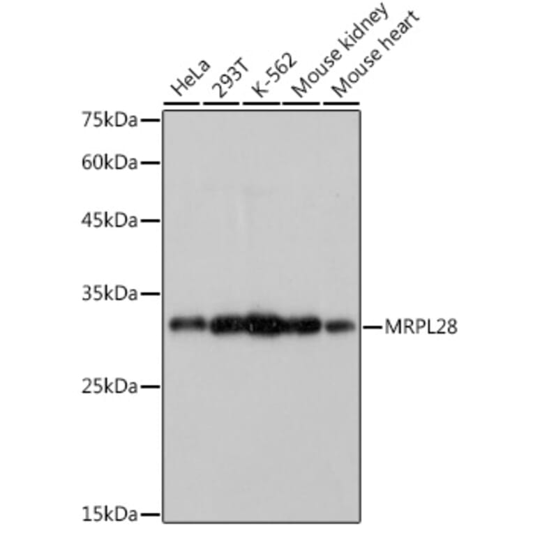 Western Blot - Anti-MRPL28 Antibody [ARC2507] (A307620) - Antibodies.com