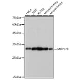 Western Blot - Anti-MRPL28 Antibody [ARC2507] (A307620) - Antibodies.com