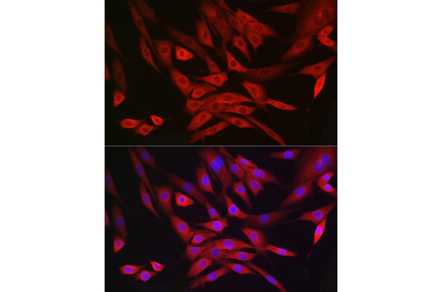 Immunofluorescence - Anti-MRPL28 Antibody [ARC2507] (A307620) - Antibodies.com