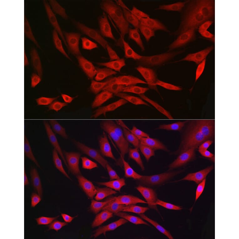 Immunofluorescence - Anti-MRPL28 Antibody [ARC2507] (A307620) - Antibodies.com