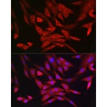 Immunofluorescence - Anti-MRPL28 Antibody [ARC2507] (A307620) - Antibodies.com