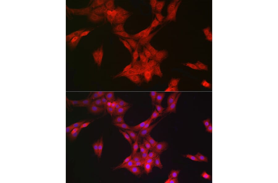 Immunofluorescence - Anti-MRPL28 Antibody [ARC2507] (A307620) - Antibodies.com