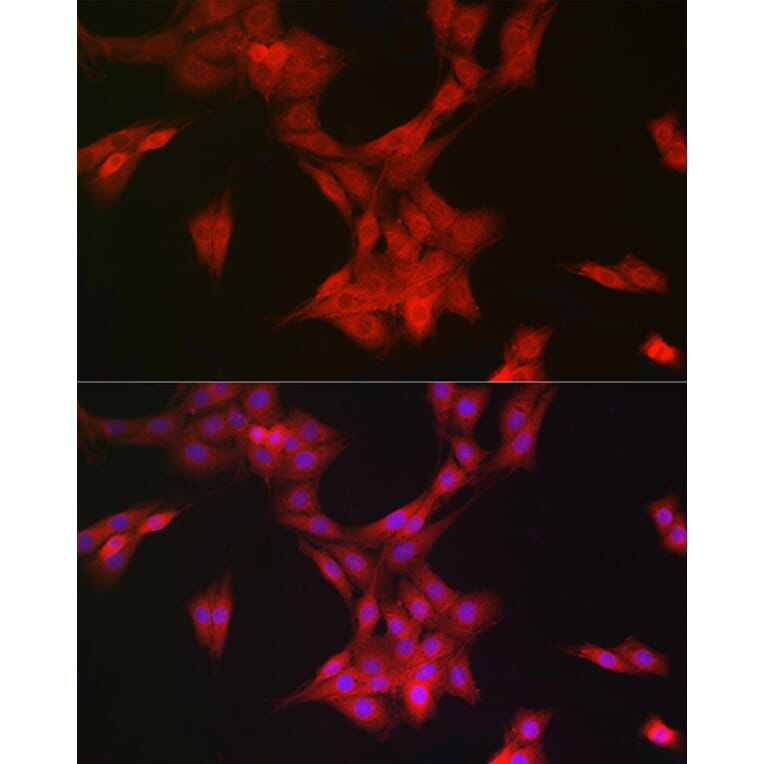 Immunofluorescence - Anti-MRPL28 Antibody [ARC2507] (A307620) - Antibodies.com