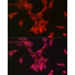 Immunofluorescence - Anti-MRPL28 Antibody [ARC2507] (A307620) - Antibodies.com