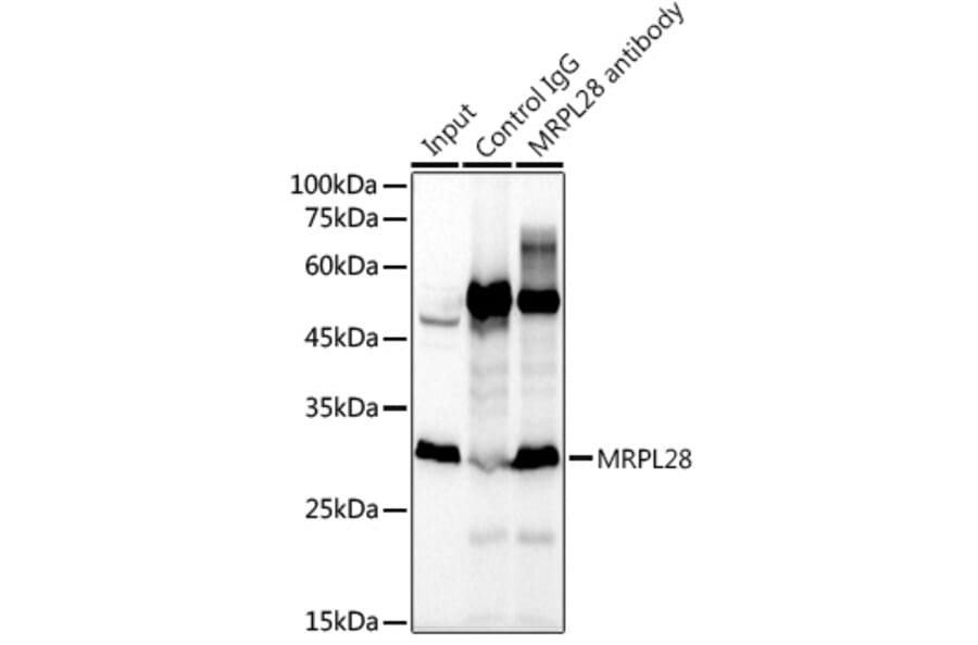 Western Blot - Anti-MRPL28 Antibody [ARC2507] (A307620) - Antibodies.com
