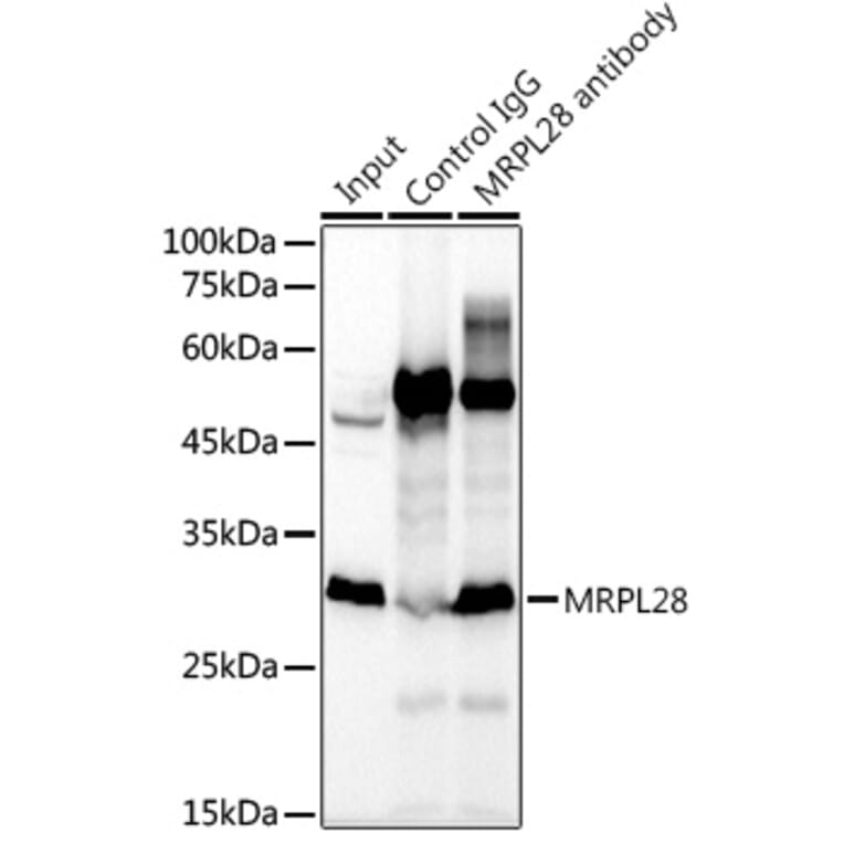 Western Blot - Anti-MRPL28 Antibody [ARC2507] (A307620) - Antibodies.com