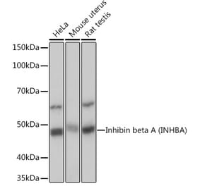 Western Blot - Anti-Inhibin beta A Antibody [ARC1177] (A307621) - Antibodies.com