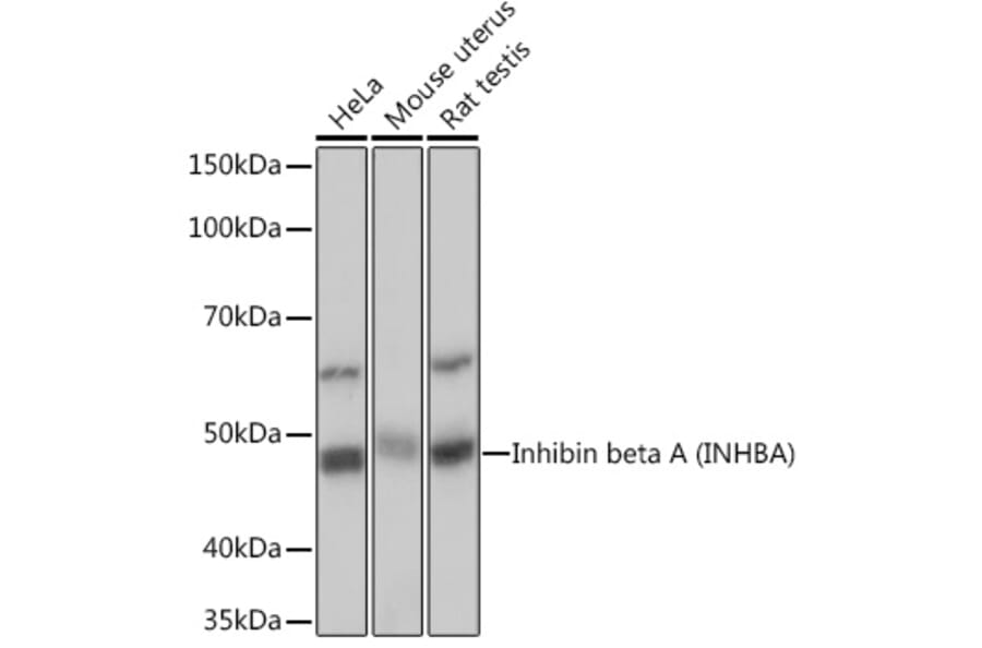 Western Blot - Anti-Inhibin beta A Antibody [ARC1177] (A307621) - Antibodies.com