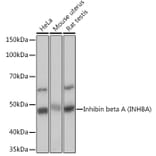 Western Blot - Anti-Inhibin beta A Antibody [ARC1177] (A307621) - Antibodies.com