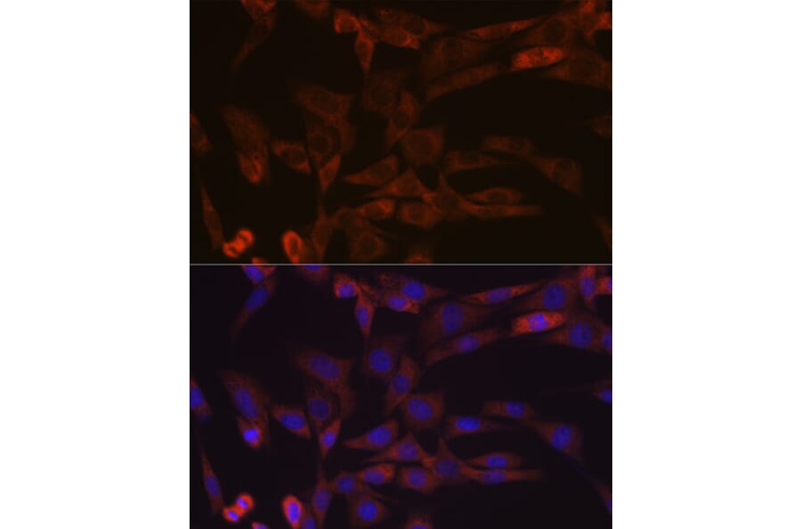 Immunofluorescence - Anti-Inhibin beta A Antibody [ARC1177] (A307621) - Antibodies.com