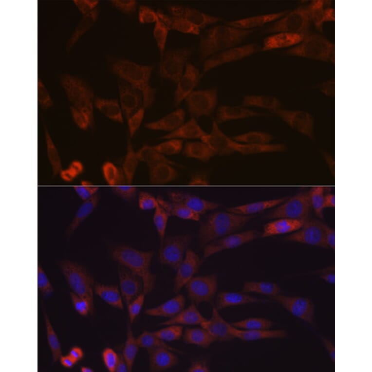 Immunofluorescence - Anti-Inhibin beta A Antibody [ARC1177] (A307621) - Antibodies.com