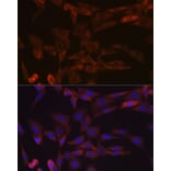 Immunofluorescence - Anti-Inhibin beta A Antibody [ARC1177] (A307621) - Antibodies.com